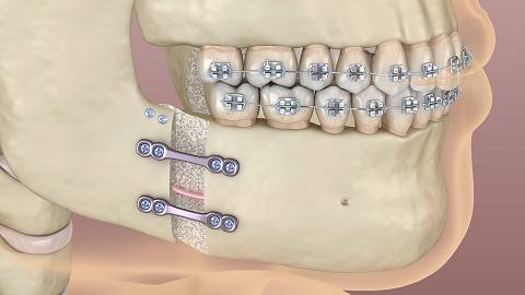 Oral Surgery