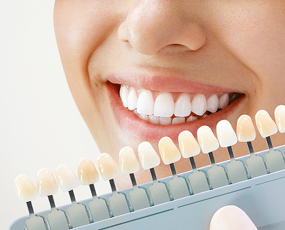 Teeth Whitening services at Neua Dental